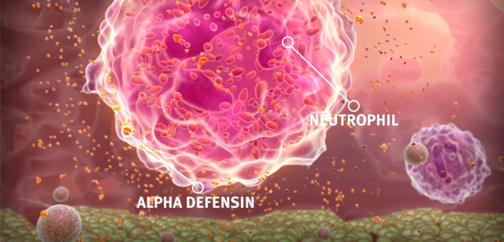 Biomarker Accurate for Periprosthetic Joint Infections