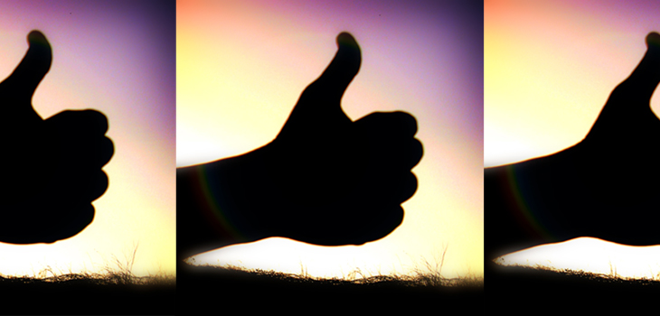 Arthrosurface Introduces New Thumb Implant