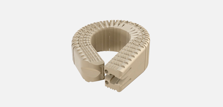 Benvenue’s Latest Expandable Implant Cleared for Sale