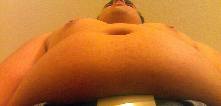 Infection, Obesity and Revised Hips. What’s the Risk?