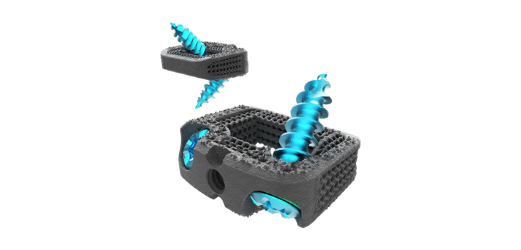 FDA Clears NEXXT MATRIXX Stand Alone Cervical System
