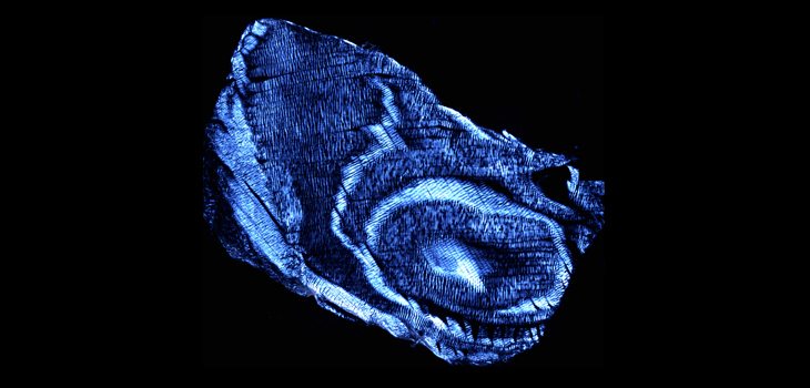 What Generates Discogenic Pain? New Landmark Research Has Answers