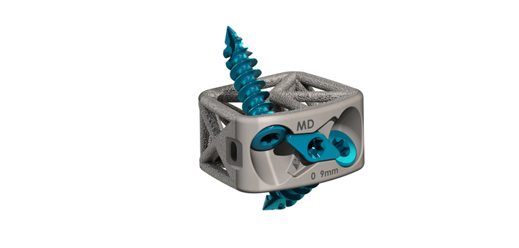 Cervical Fusion Device Using Truss Implant Technology™ FDA Cleared