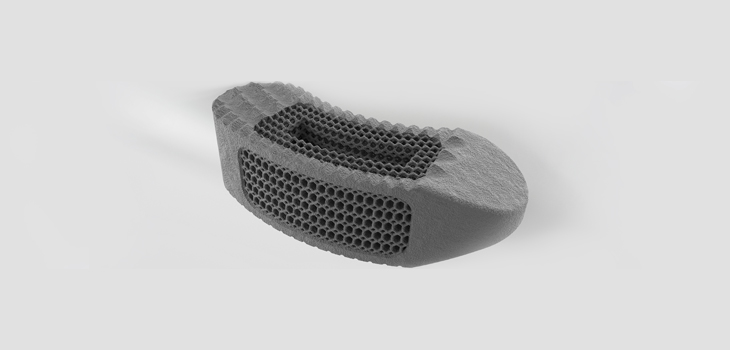 Zimmer Biomet Launches TrellOss-TC TLIF Platform