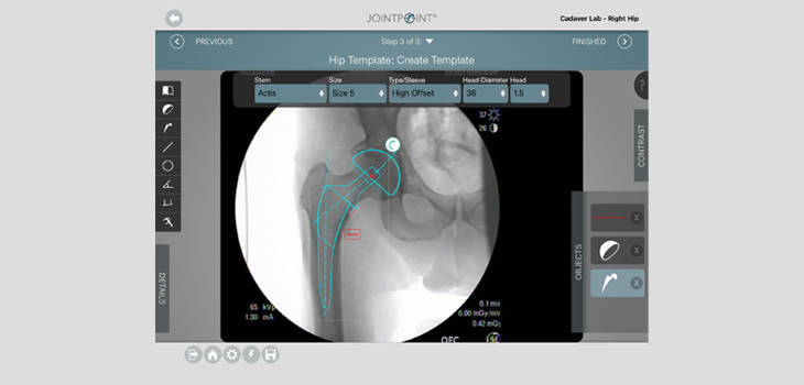 DePuy Synthes to Acquire Assets of JointPoint, Inc.