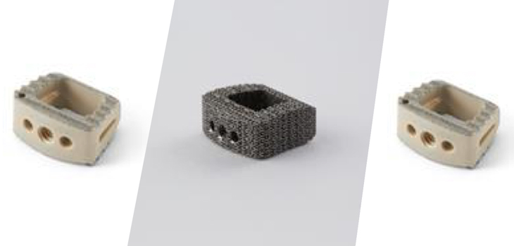Xtant Medical Launches Three Novel Spinal Implants