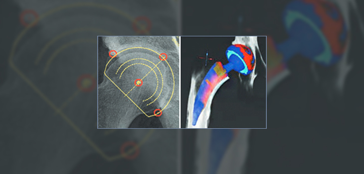 Japan Regulators Approve mediCAD’s 2D and 3D Modules
