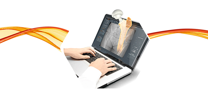 1st Cases Using hipEOS 3.0, Intellijoint Smart Nav Combo Announced