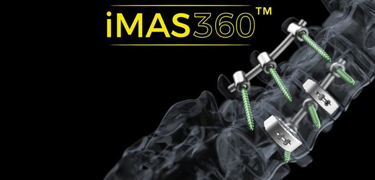 New Clinical Data for Biedermann’s iMAS360