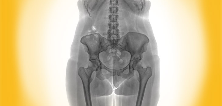 First Photon Counting Imaging System Cleared by FDA