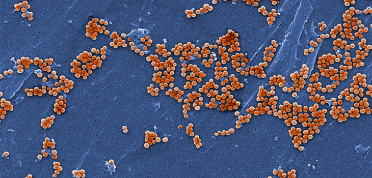 ASC Surgical Site Infections – How Big Is the Risk?