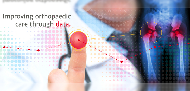 Over 1.5 Million Arthroplasty Procedures in AJRR Database