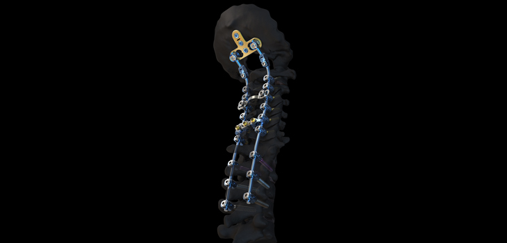 SYMPHONY Occipito-Cervico-Thoracic System Launched