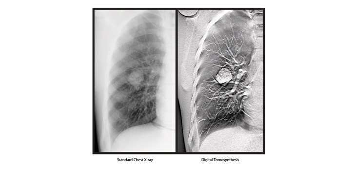 FDA-Cleared Carestream Radiography System Promises Enhanced Clarity