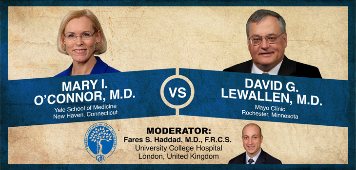 O’Connor v. Lewallen: Patient Specific TKA Provides Improved Satisfaction
