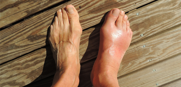 Umbilical Cord Allograft May Improve Ankle Repair Outcomes