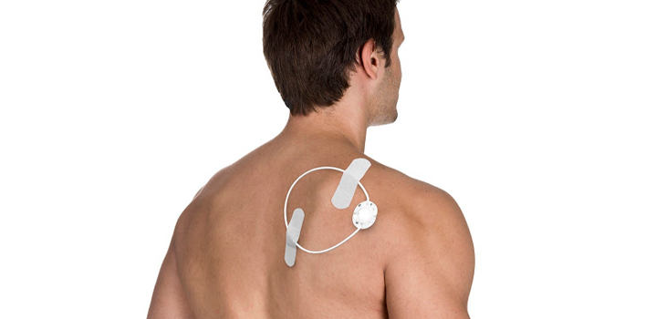ActiPatch Now Cleared for “All” Musculoskeletal Pain