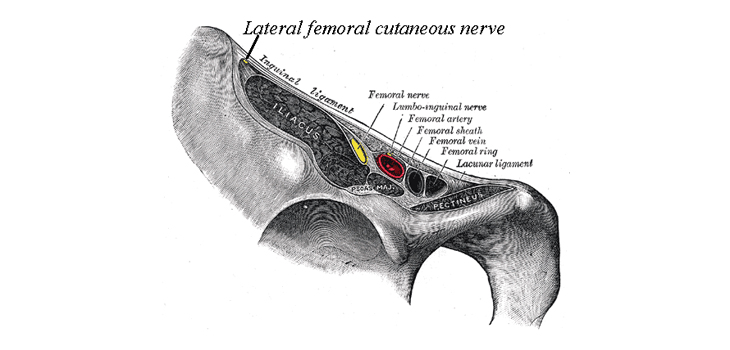 THA: Nerve Injuries Differ in DAA and Posterior Approach