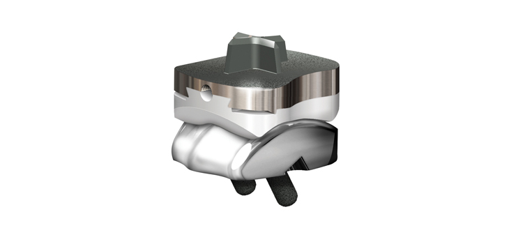 Total Ankle With Patient CT Guided Tech Cleared by FDA