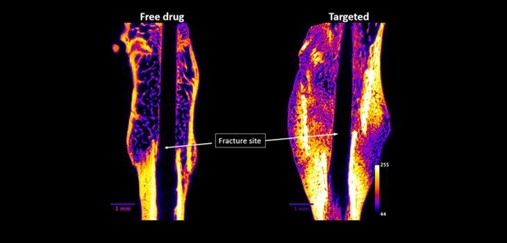 Targeted Bone Healing Drug From Purdue