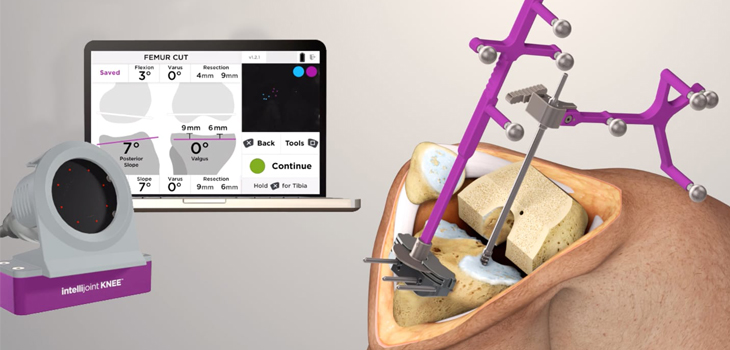 Intellijoint Surgical Releases Intellijoint KNEE