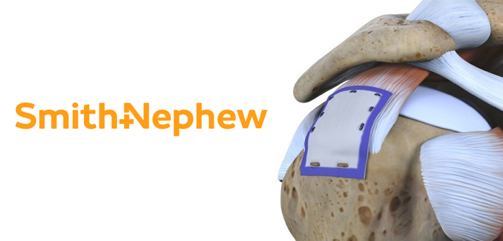 Tendon Regeneration Implant Receives CE Mark