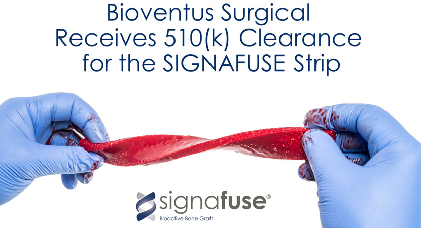 FDA Clears Bioventus’ Signafuse® Bone Graft Strips