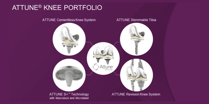 DePuy Synthes’ ATTUNE Knee Hits 1 Million Patient Milestone