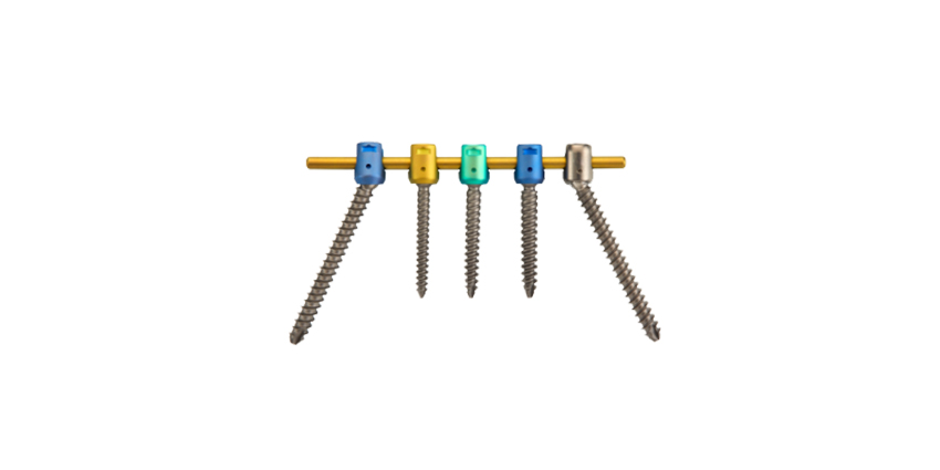 Nationwide Commercial Launch of ulrich’s Posterior Fixation System