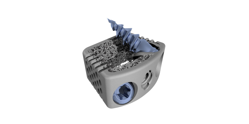 FDA Clears Novel CoreLink 3D Stand-alone Cervical System