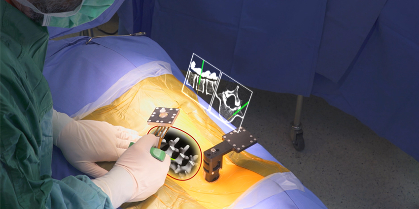 Rush University Amazed at Revolutionary MIS Vision Tool