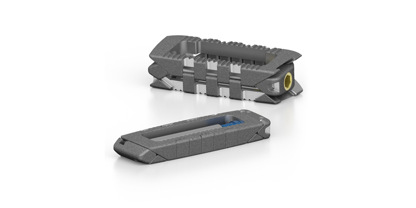 Life Spine Initiates Prolift Lateral Interbody Study