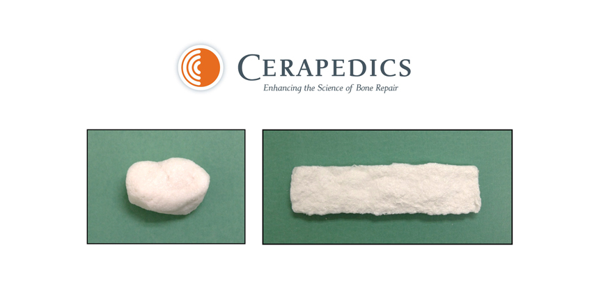 With a Recent FDA Ruling, Cerapedics Takes Aim at Infuse