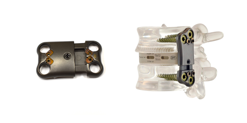 New Line of Expandable Lumbar Fusion Plates Launched