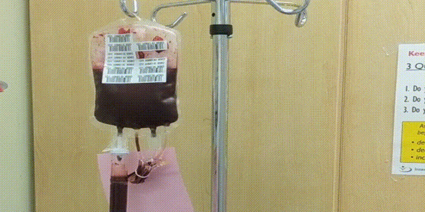 How to Optimize Revision Cases to Decrease Transfusions