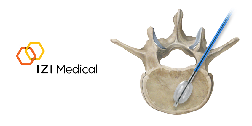 IZI Medical Expands VCF Portfolio With Balloon Kyphoplasty Option