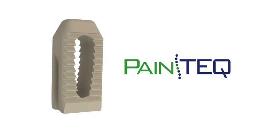 Prospective Study Announced for Sacroiliac Joint Fusion Device