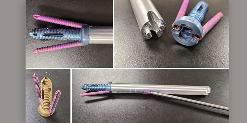 Healthcare Provider Takes Initiative on Instrument Design