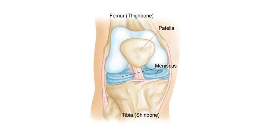 Breakthrough Designation to NovoPedics’ Meniscus Replacement