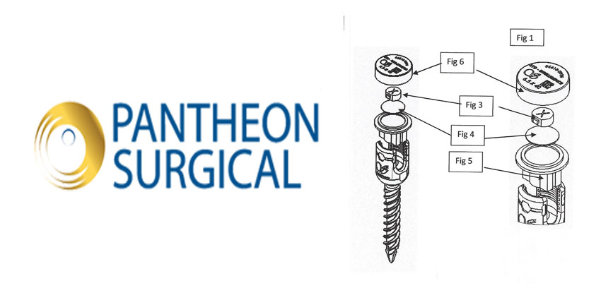 Patent Granted for Implant/Instrument Tracking System
