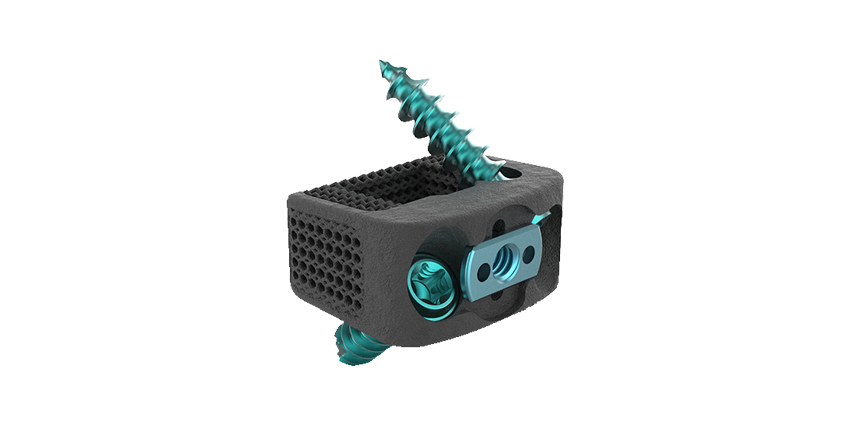 Stand-Alone Cervical System Updated With Turn Lock
