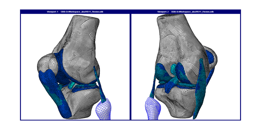 Validated 12-Point Knee Mathematical Model Announced