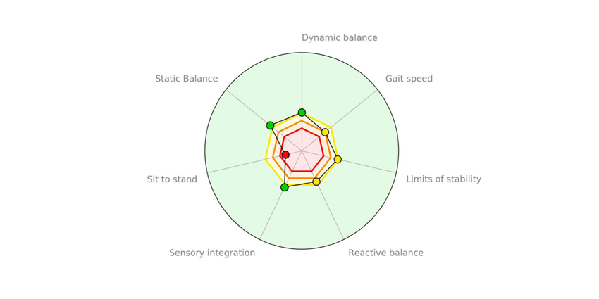 AI Beats Traditional Evaluation in Predicting Elderly Falls