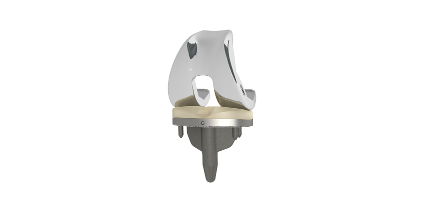 Total Joint Orthopedics Announces Partnership With THINK Surgical