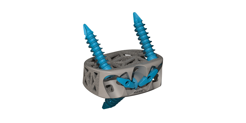 Novel Stand-Alone Anterior Lumbar Device Launched