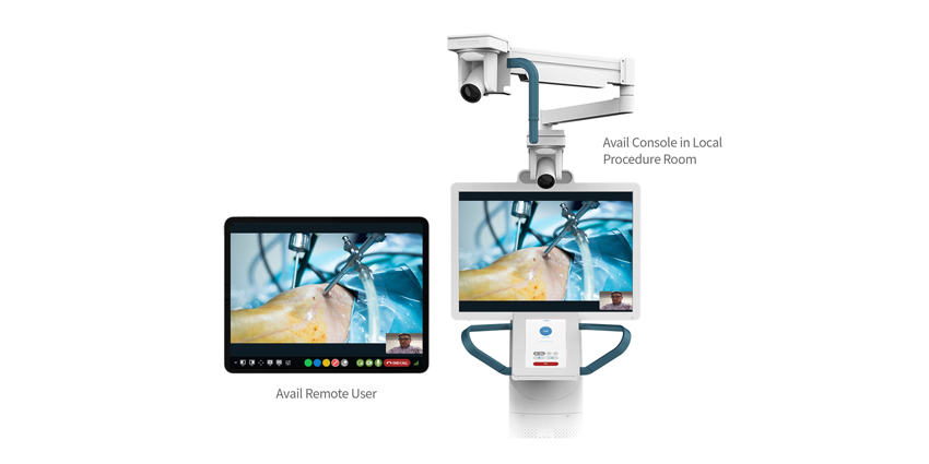 Smith+Nephew Joins Forces With Avail Medsystems