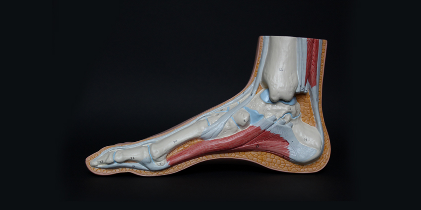 Achilles Tendon Repair: Little Benefit to Early Mobilization