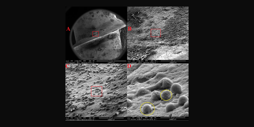 Landmark Study: 1st Visual Biofilm Evidence From “Aseptic” Surgery