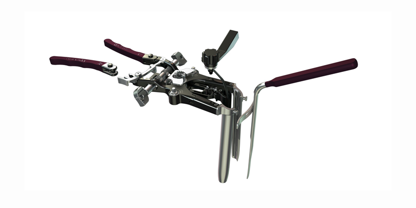 Study Supports Use of NuVasive Retractor for Prone XLIF Procedures