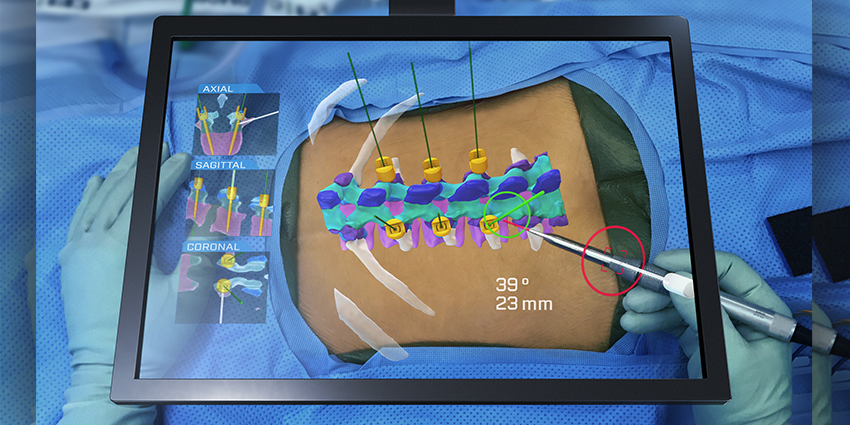 Surgalign Closes Landmark, Transformative Holo Surgical Purchase